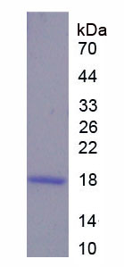 Recombinant Proprotein Convertase Subtilisin/Kexin Type 2 (PCSK2)