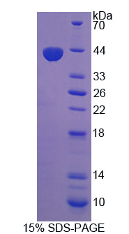 Recombinant Proprotein Convertase Subtilisin/Kexin Type 5 (PCSK5)