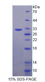 RPE189Hu01.jpg