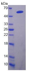 Recombinant Proprotein Convertase Subtilisin/Kexin Type 9 (PCSK9)