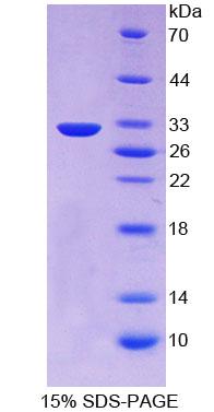 Recombinant Proprotein Convertase Subtilisin/Kexin Type 1 (PCSK1)