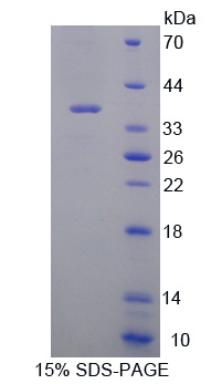 Recombinant Proprotein Convertase Subtilisin/Kexin Type 1 (PCSK1)