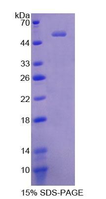 RPE214Hu01.jpg