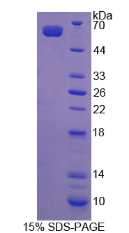 RPE217Hu01.jpg