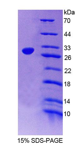 RPE226Hu01.jpg