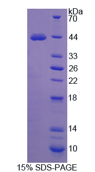 RPE254Hu01.jpg