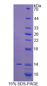 RPE258Hu01.jpg