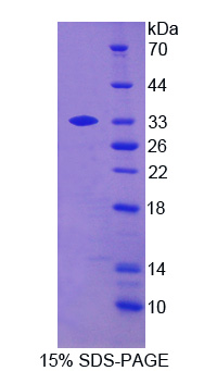 Recombinant B-Lymphoid Tyrosine Kinase (BLK)