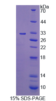 Recombinant C-Mer Proto Oncogene Tyrosine Kinase (MERTK)