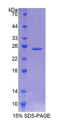 Recombinant Sialidase 2, Cytosolic (SIAL2)