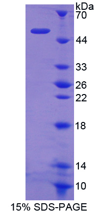 Recombinant Ras Homolog Gene Family, Member Q (RHOQ)