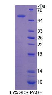 RPE330Hu01.jpg