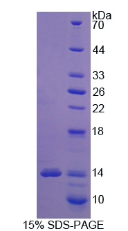 RPE342Hu01.jpg