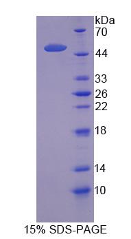 Recombinant Solute Carrier Family 1, Member 5 (SLC1A5)