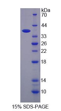 Recombinant Na-K-Cl Cotransporter 2 (NKCC2)