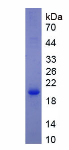 RPE381Hu01.jpg