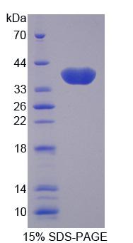 RPE461Hu01.jpg