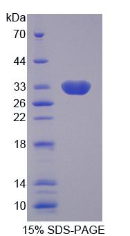 RPE463Hu01.jpg