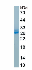 Recombinant Electron Transfer Flavoprotein Alpha Polypeptide (ETFa)