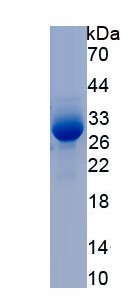 Recombinant Electron Transfer Flavoprotein Alpha Polypeptide (ETFa)