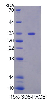 RPE528Hu01.jpg