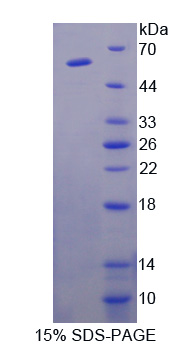 RPE544Hu01.jpg