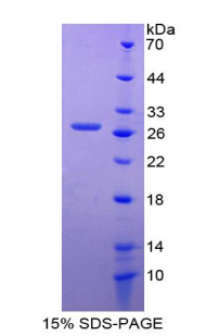 RPE569Hu01.jpg