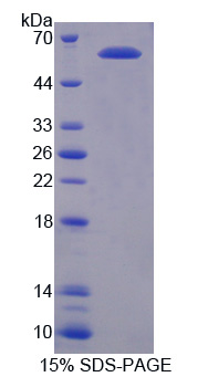 RPE590Hu01.jpg