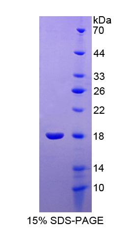 Recombinant Ubiquitin Conjugating Enzyme E2I (UBE2I)