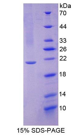 RPE602Hu01.jpg