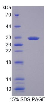 RPE635Hu01.jpg