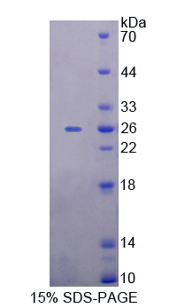 RPE651Hu01.jpg