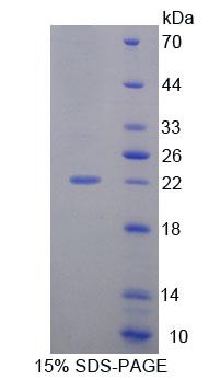 RPE656Hu01.jpg