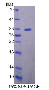 Recombinant Ubiquitin Conjugating Enzyme E2S (UBE2S)