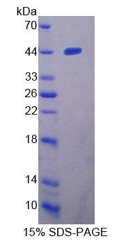 Recombinant Tryptophanyl tRNA Synthetase 2, Mitochondrial (WARS2)