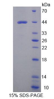 Recombinant Tryptophanyl tRNA Synthetase 2, Mitochondrial (WARS2)