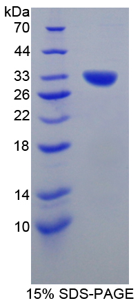 Recombinant Glomulin (GLMN)