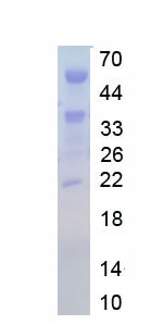 RPE689Hu01.jpg