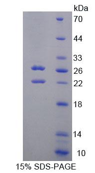 Recombinant Sphingosine Kinase 2 (SPHK2)