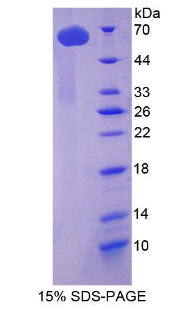 RPE718Hu01.jpg