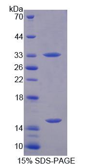 Recombinant Phosphoglucomutase 3 (PGM3)