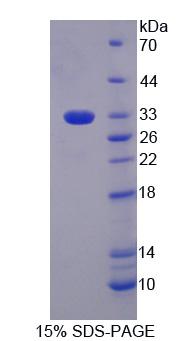 Recombinant Phosphoglucomutase 3 (PGM3)