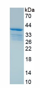 Recombinant Karyopherin Alpha 5 (KPNa5)