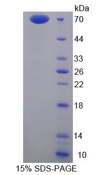 Recombinant Annexin A9 (ANXA9)