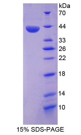 Recombinant Annexin A10 (ANXA10)