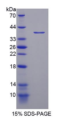 Recombinant Nuclear Receptor Coactivator 3 (NCOA3)