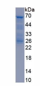 RPE801Hu01.jpg