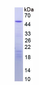 Recombinant Histone Deacetylase 3 (HDAC3)