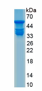 Recombinant Histone Deacetylase 4 (HDAC4)