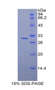 Recombinant Histone Deacetylase 6 (HDAC6)